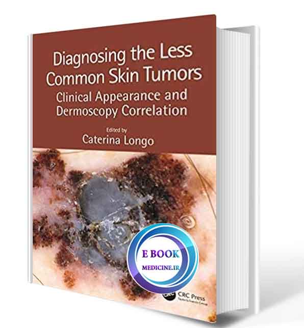 دانلود کتابDiagnosing the Less Common Skin Tumors: Clinical Appearance and Dermoscopy Correlation2019 (ORIGINAL PDF)